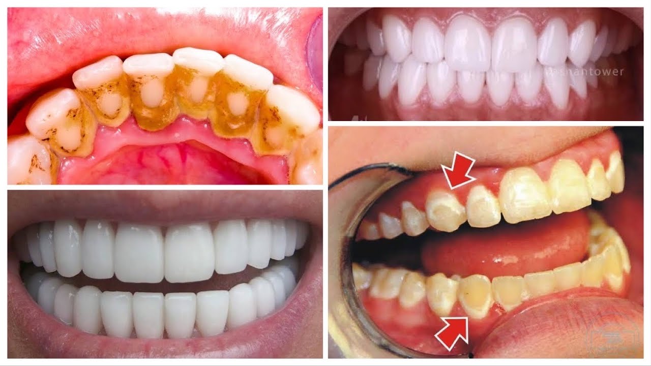 معجون الأسنان لإبتسامة صحية بخلاصة الألوفيرا وصمغ النحل والنعناع الآن